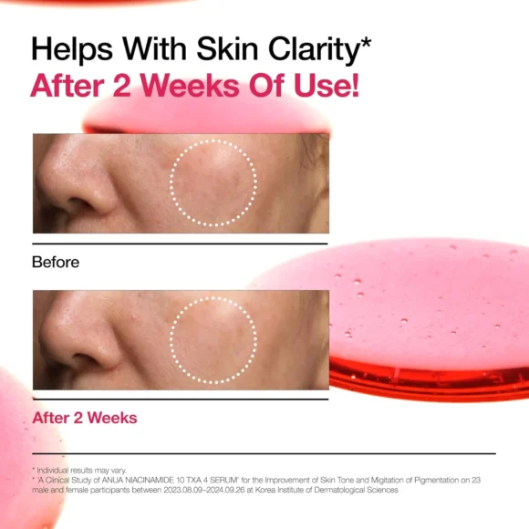 Anua - Niacinamide 10% + TXA 4% Serum 30ml - Image 4